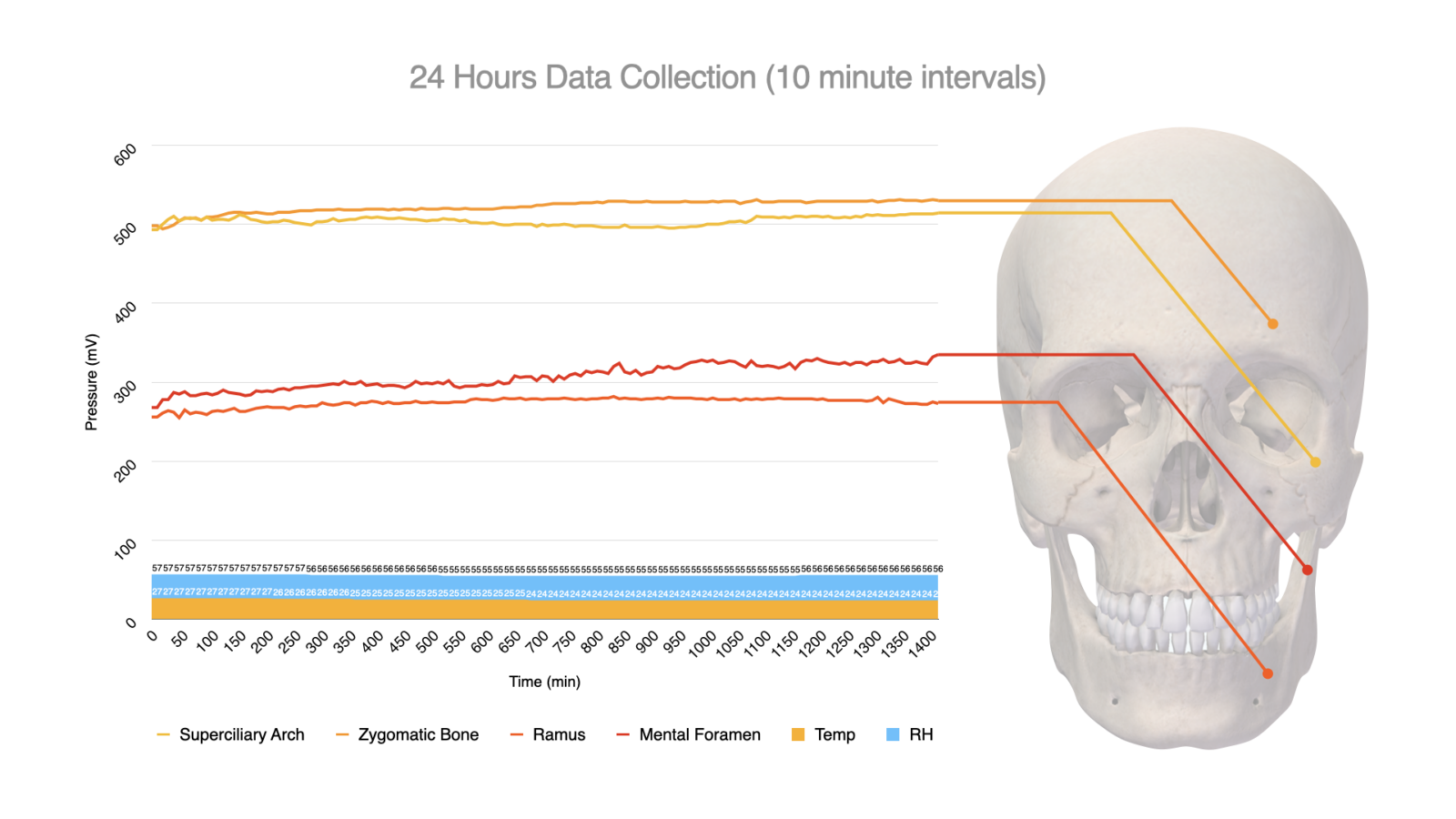The image shows a graph for the 24-hour data collection with 10 minutes intervals. The vertical axis marked pressure (mV) and is from 0 to 600, and the horizontal axis is marked Time (min) and is from 0 to 1400.
An image of a human skull from the front is marked with the location of 4 sensors. Lines start from different places; however, all show a slight increase in the pressure over 24 hours.
At the bottom of the graph, relative humidity and temperature are shown at around 25 degrees Celcius and 55%, respectively. 